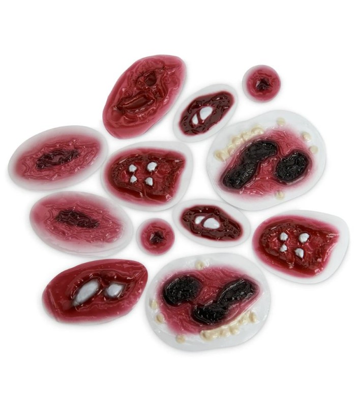 Set of 12 simulated wound models | MMF.fr