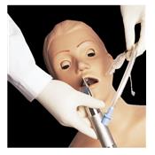 Torse d'intubation